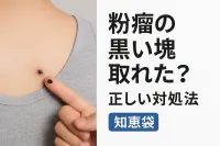 粉瘤の黒い塊取れた？正しい対処法【知恵袋】
