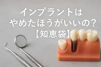 インプラントはやめたほうがいいの？【知恵袋】