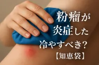 粉瘤が炎症したときは冷やすべき？【知恵袋】