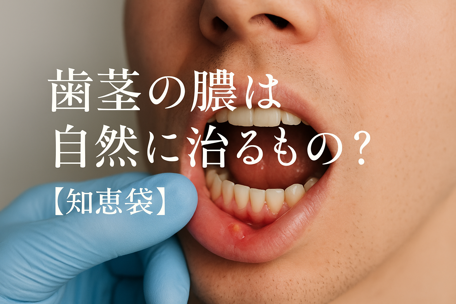 歯茎の膿は自然に治るもの？【知恵袋】