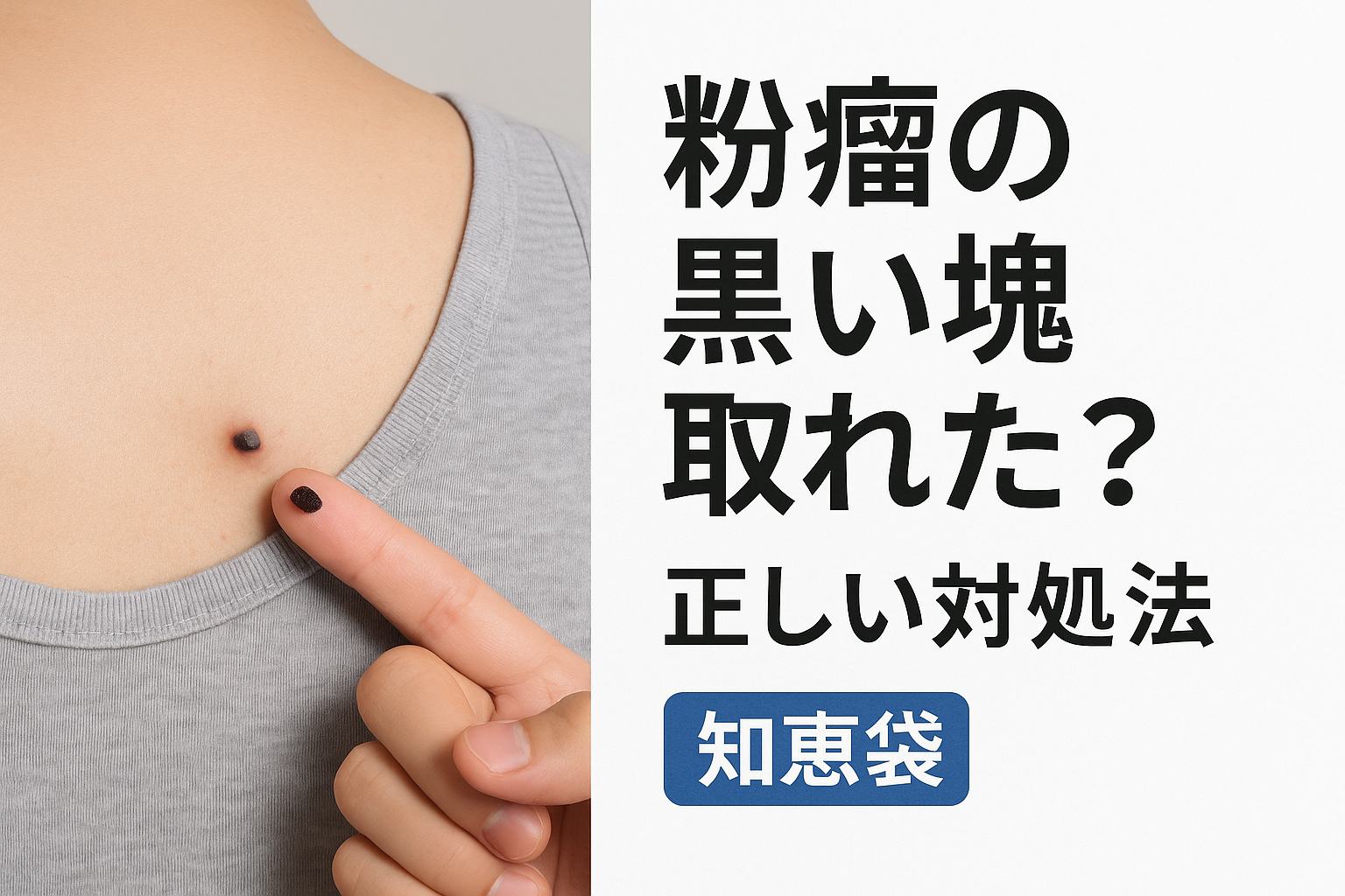 粉瘤の黒い塊取れた？正しい対処法【知恵袋】