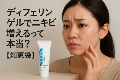 ディフェリンゲルでニキビ増えるって本当？【知恵袋】