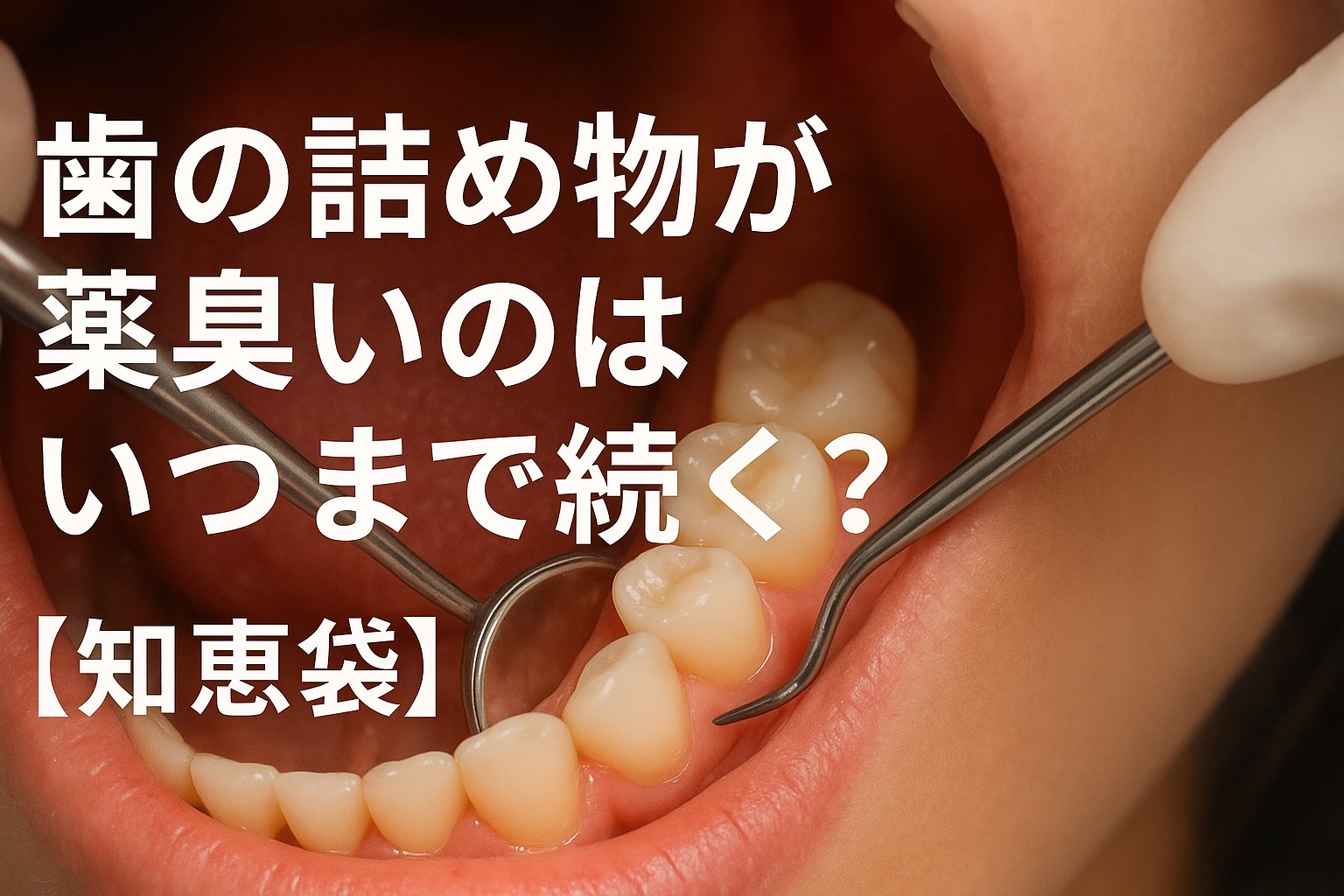歯の詰め物が薬臭いのはいつまで続く?【知恵袋】