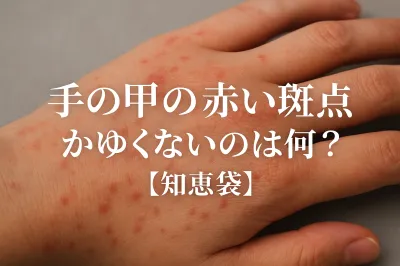 手の甲の赤い斑点でかゆくないのは何？【知恵袋】