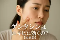 ゲンタシンはニキビに効くの？【知恵袋】