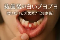 抜歯後の白いブヨブヨ、取れたけど大丈夫？【知恵袋】