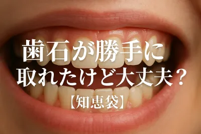 歯石が勝手に取れたけど大丈夫？【知恵袋】