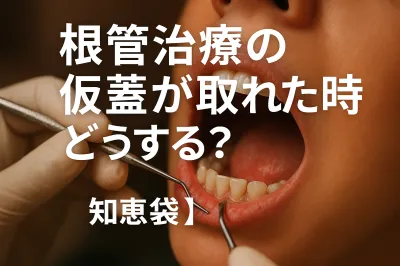 根管治療の仮蓋が取れた時どうする？【知恵袋】