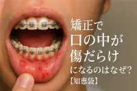 矯正で口の中が傷だらけになるのはなぜ？【知恵袋】