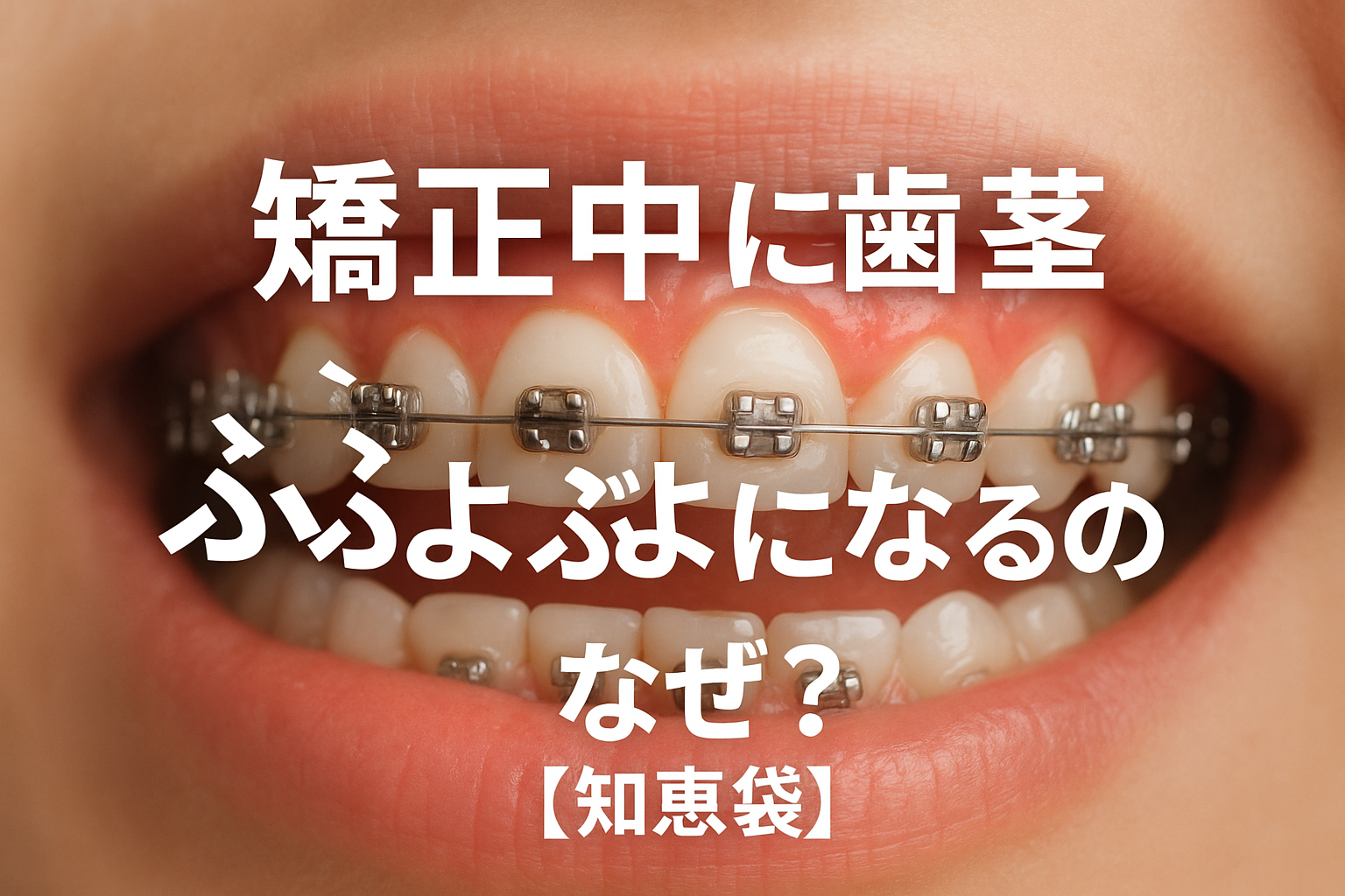 矯正中に歯茎がぶよぶよになるのはなぜ?【知恵袋】