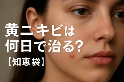黄ニキビは何日で治る？【知恵袋】