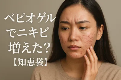 ベピオゲルでニキビ増えた?【知恵袋】