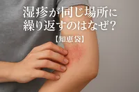 湿疹が同じ場所に繰り返すのはなぜ？【知恵袋】