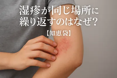 湿疹が同じ場所に繰り返すのはなぜ？【知恵袋】
