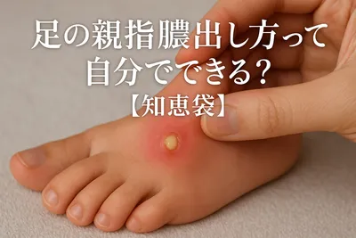 足の親指膿出し方って自分でできる？【知恵袋】