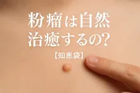 粉瘤は自然治癒するの?【知恵袋】