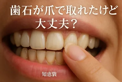 歯石が爪で取れたけど大丈夫？【知恵袋】