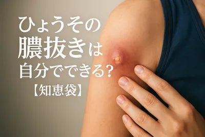 ひょうその膿抜きは自分でできる？【知恵袋】