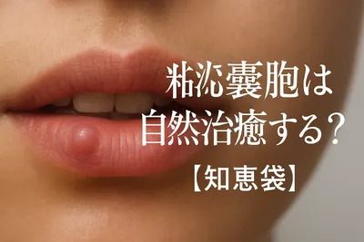 粘液嚢胞は自然治癒するの？【知恵袋】