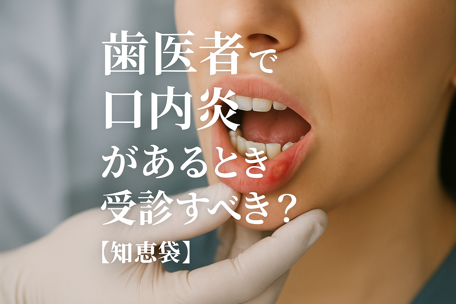 歯医者で口内炎があるとき受診すべき？【知恵袋】