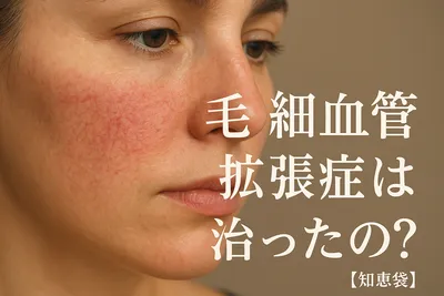 毛細血管拡張症は治ったの？【知恵袋】