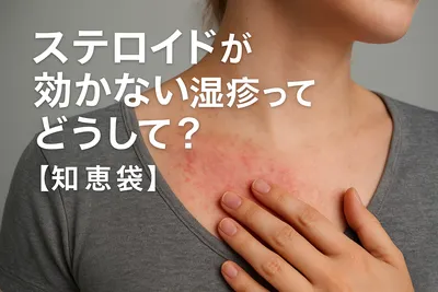 ステロイドが効かない湿疹ってどうして？【知恵袋】