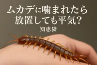 ムカデに噛まれたら放置しても平気？【知恵袋】
