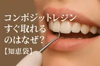 コンポジットレジンすぐ取れるのはなぜ?【知恵袋】