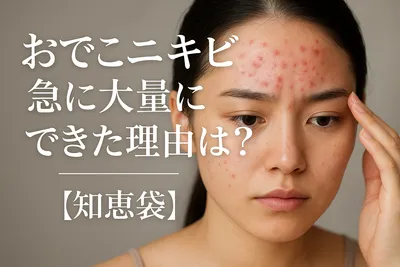 おでこニキビが急に大量にできた理由は？【知恵袋】