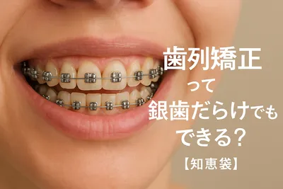 歯列矯正って銀歯だらけでもできる？【知恵袋】