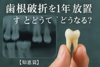 歯根破折を1年放置するとどうなる?【知恵袋】