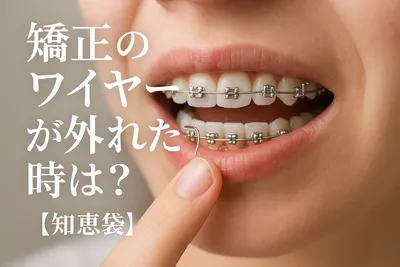 矯正のワイヤーが外れた時は？【知恵袋】