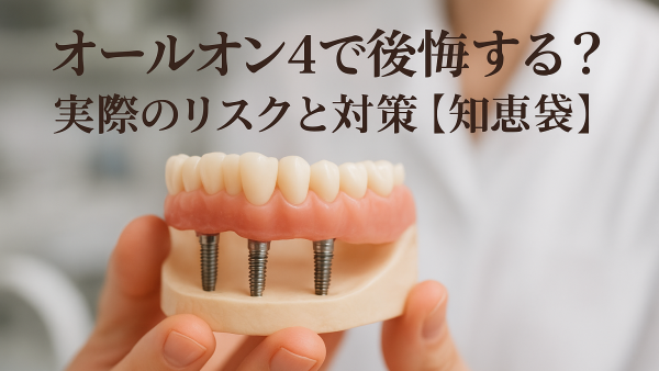 オールオン4で後悔する？ 実際のリスクと対策【知恵袋】