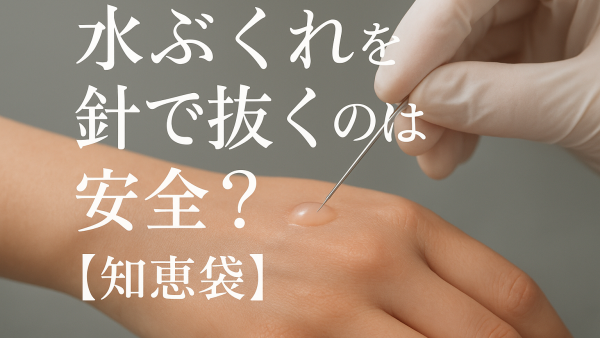 水ぶくれを針で抜くのは安全？【知恵袋】