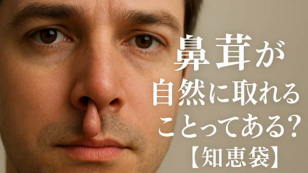 鼻茸が自然に取れることってある？【知恵袋】