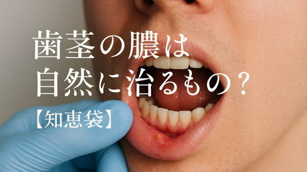 歯茎の膿は自然に治るもの？【知恵袋】