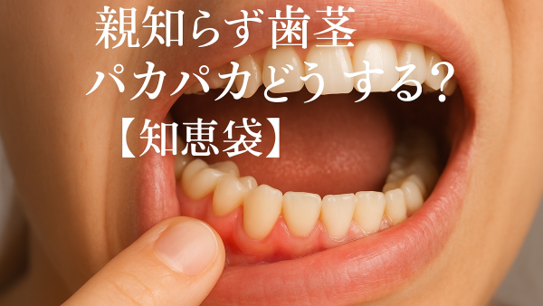 親知らず歯茎パカパカどうする？【知恵袋】